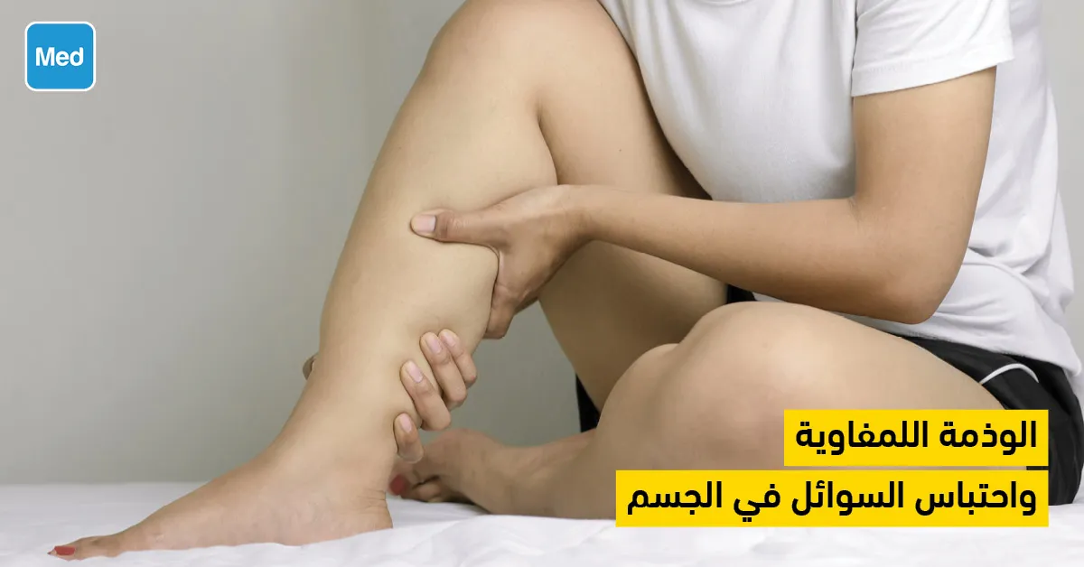 الوذمة اللمفاوية واحتباس السوائل في الجسم